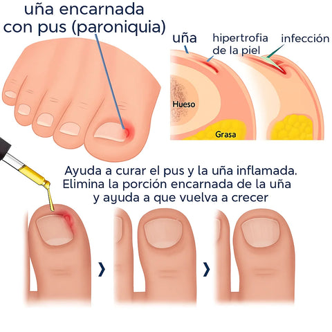 Producto