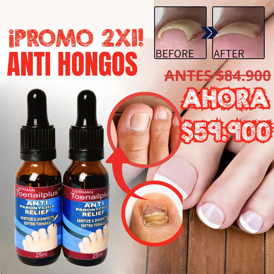 Anti-Paronychia Relief Oil – El alivio natural para tus uñas en solo 72 h 🕒 | ¡Promoción 2×1!